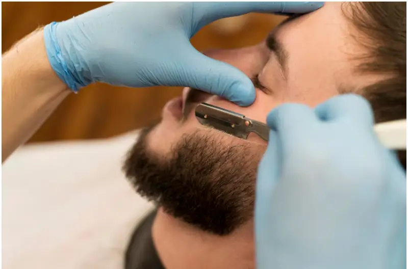 Beard transplant in Istanbul